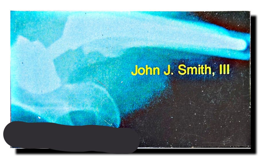 Hip Replacement Card left.jpg