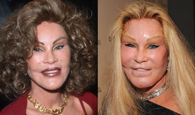 plastic_surgery.jpg