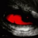 BlackWolfe